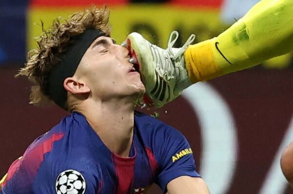 (ВИДЕО) ФЕРМИН ДОЖИВЕА НОКАУТ, ДОБИ НЕКОЛКУ КОНЦИ И ПРОДОЛЖИ ДА ИГРА